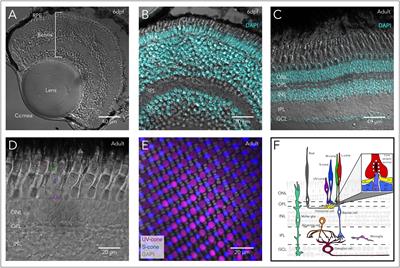 Leveraging Zebrafish to Study Retinal Degenerations